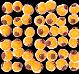 03 fat cells insulin resistance diabetes hooray good health com